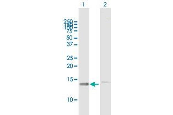 TRMT112 anticorps  (AA 1-125)
