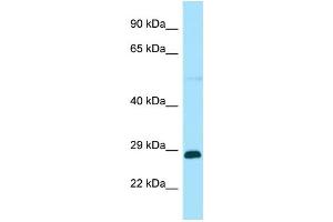 Western Blotting (WB) image for anti-RAB GTPase Activating Protein 1-Like (RABGAP1L) (Middle Region) antibody (ABIN2790497) (RABGAP1L antibody  (Middle Region))