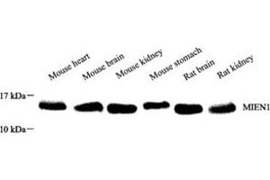 Western blot analysis of MIEN1 (ABIN7073498) at dilution of 1: 200 (C17orf37 antibody)