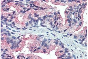 Anti-TM9SF3 antibody IHC staining of prostate, human. (TM9SF3 antibody  (Internal Region))