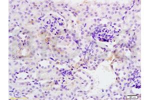 Formalin-fixed and mouse kidney tissue labeled with Anti-SOD2 Polyclonal Antibody, Unconjugated (ABIN737361) at 1:200 followed by conjugation to the secondary antibody and DAB staining (SOD2 antibody  (AA 41-78))