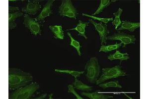 Immunofluorescence of purified MaxPab antibody to ZYX on HeLa cell. (ZYX antibody  (AA 1-572))