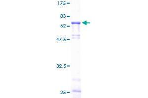 Image no. 1 for Galactosidase, alpha (GLA) (AA 1-429) protein (GST tag) (ABIN1355176) (GLA Protein (AA 1-429) (GST tag))