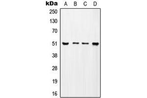 Western blot analysis of ADA2A expression in MCF7 (A), SP2/0 (B), H9C2 (C), mouse testis (D) whole cell lysates.
