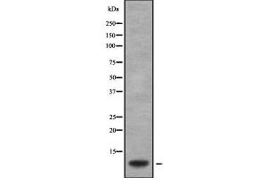 Western blot analysis GNG2 using Jurkat whole cell lysates (GNG2 antibody  (Internal Region))
