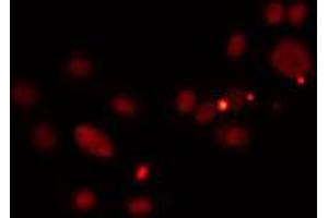 ABIN6274511 staining HuvEc cells by IF/ICC. (PRDM12 antibody  (Internal Region))