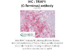 Image no. 1 for anti-TNF Receptor-Associated Factor 1 (TRAF1) (C-Term) antibody (ABIN1740243) (TRAF1 antibody  (C-Term))