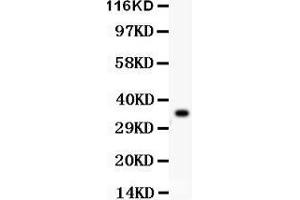 Western Blotting (WB) image for anti-Glutathione Peroxidase 1 (GPX1) (AA 116-146), (Middle Region) antibody (ABIN3043834)