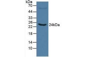 Detection of CRP in Human Serum using Monoclonal Antibody to C Reactive Protein (CRP) (CRP antibody  (AA 20-225))