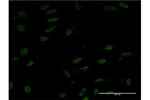 Immunofluorescence of monoclonal antibody to CRTC1 on HeLa cell.