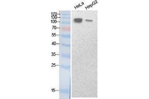 Western Blotting (WB) image for anti-Sterol Regulatory Element Binding Transcription Factor 1 (SREBF1) (Internal Region) antibody (ABIN3187988) (SREBF1 antibody  (Internal Region))