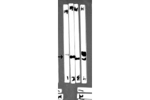 Western blot analysis of extracts from Mouse spleen tissue,Rat spleen tissue,HEK293 and 293T cells, using EFNB2 antibody (df7450) at 1/1000 dilution. (Ephrin B2 antibody  (C-Term))