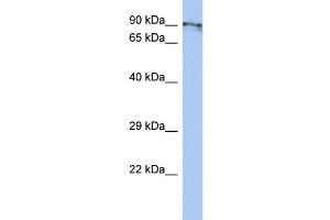 WB Suggested Anti-CXorf20 Antibody Titration: 0. (BEND2 antibody  (Middle Region))