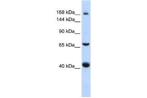 Western Blotting (WB) image for anti-ATP-Binding Cassette, Sub-Family C (CFTR/MRP), Member 9 (ABCC9) antibody (ABIN2458769) (ABCC9 antibody)