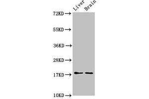 Western Blot Positive WB detected in: Mouse liver tissue, Mouse brain tissue All lanes: HSPB6 antibody at 3 μg/mL Secondary Goat polyclonal to rabbit IgG at 1/50000 dilution Predicted band size: 18 kDa Observed band size: 18 kDa (HSPB6 antibody  (AA 1-160))
