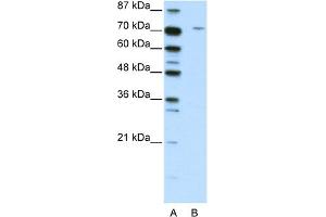 WB Suggested Anti-LZTS1 Antibody Titration:  2. (LZTS1 antibody  (C-Term))