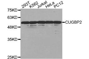 Western Blotting (WB) image for anti-CUGBP, Elav-Like Family Member 2 (CELF2) antibody (ABIN1877045) (CELF2 antibody)