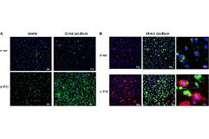 Immunofluorescence (IF) image for anti-Collagen, Type I (COL1) antibody (ABIN135046)