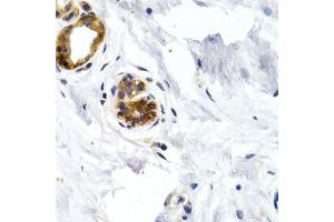 Immunohistochemistry of paraffin-embedded human normal breast using GDF5 antibody at dilution of 1:200 (400x lens). (GDF5 antibody)