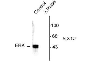 Image no. 1 for anti-MAPK1/2 (pThr202), (pTyr204) antibody (ABIN361504) (MAPK1/2 (pThr202), (pTyr204) antibody)
