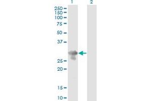 Western Blot analysis of PCGF5 expression in transfected 293T cell line by PCGF5 monoclonal antibody (M01), clone 3C10. (PCGF5 antibody  (AA 51-148))