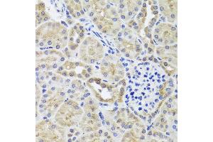Immunohistochemistry of paraffin-embedded mouse kidney using CGB7 antibody at dilution of 1:100 (x40 lens).