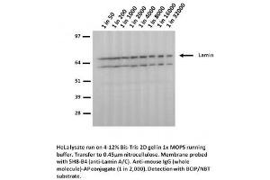 Image no. 1 for anti-Lamin A/C (LMNA) (Arg482Trp-Mutant) antibody (ABIN1042617) (Lamin A/C antibody  (Arg482Trp-Mutant))