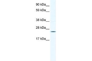 KCTD6 antibody used at 0. (KCTD6 antibody  (N-Term))