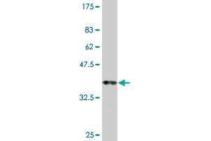 ROBO2 antibody  (AA 441-540)