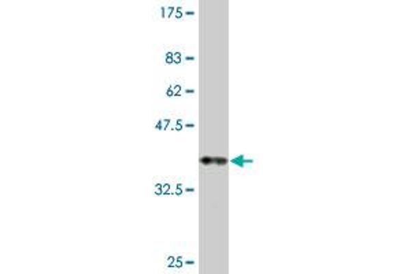 ROBO2 antibody  (AA 441-540)