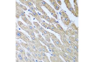 Immunohistochemistry of paraffin-embedded human liver using FUT6 antibody at dilution of 1:100 (40x lens).