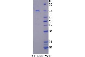 Image no. 1 for Arginase, Type II (ARG2) (AA 23-354) protein (His tag) (ABIN6238368) (ARG2 Protein (AA 23-354) (His tag))