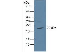Western blot analysis of Rat Heart Tissue. (TIRAP antibody  (AA 1-221))