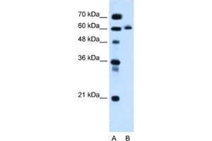 Western Blotting (WB) image for anti-Inositol 1,4,5-Triphosphate Receptor Interacting Protein-Like 1 (ITPRIPL1) antibody (ABIN2463966) (ITPRIPL1 antibody)