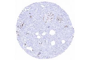 Recombinant INSM1 antibody  (AA 81-125)