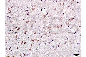Formalin-fixed and paraffin embedded rat brain tissue labeled Anti-NF-H/Neurofilament H/Neurofilament 200 Polyclonal Antibody (ABIN672156), Unconjugated at 1:200, followed by conjugation to the secondary antibody and DAB staining (NEFH antibody  (AA 1-100))