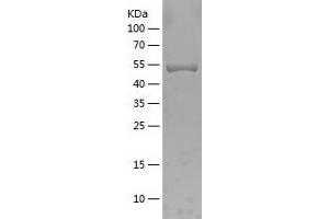 Western Blotting (WB) image for Cyclin D1 (CCND1) (AA 11-285) protein (His-IF2DI Tag) (ABIN7282260) (Cyclin D1 Protein (CCND1) (AA 11-285) (His-IF2DI Tag))