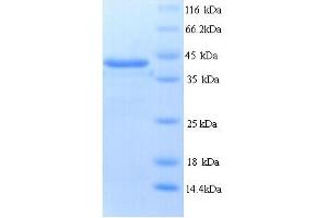 SDS-PAGE (SDS) image for Protein tyrosine Phosphatase, Receptor Type, B (PTPRB) (AA 1643-1997) protein (His tag) (ABIN5713768)
