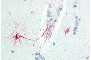 Human Brain, Cortex: Formalin-Fixed, Paraffin-Embedded (FFPE) (DOK6 antibody  (AA 111-160))