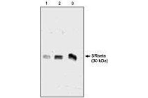Western blot analysis  using SRβ antibody  ng  of canine microsomal protein  Chicken, Dog (SRPRB antibody  (AA 246-265))