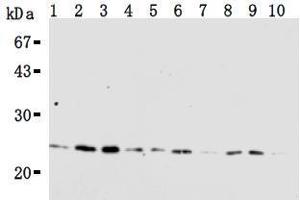 Western Blotting (WB) image for anti-RAN, Member RAS Oncogene Family (RAN) antibody (ABIN1449197) (RAN antibody)
