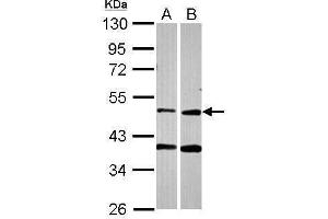 WB Image Sample (30 ug of whole cell lysate) A: A549 B: HCT116 10% SDS PAGE antibody diluted at 1:2000 (PPOX antibody)