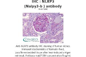 Image no. 1 for anti-NLR Family, Pyrin Domain Containing 3 (NLRP3) antibody (ABIN1724101) (NLRP3 antibody)