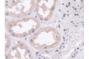 Immunohistochemistry (IHC) image for anti-Phospholipase D (PLD) (AA 725-1074) antibody (ABIN7434611)