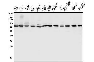 Western blot analysis of DLL1 using anti-DLL1 antibody (ABIN7600324).