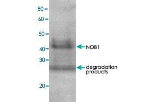 Detection of RPN7 (51. (NOB1 antibody)