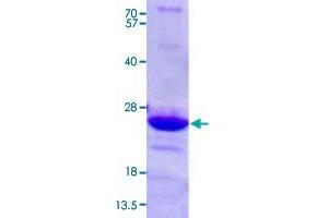 Image no. 1 for Endomucin (EMCN) (AA 19-190) protein (His tag) (ABIN5569831)
