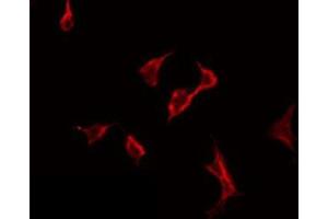 ABIN6275784 staining HeLa by IF/ICC. (PLA2G6 antibody  (Internal Region))