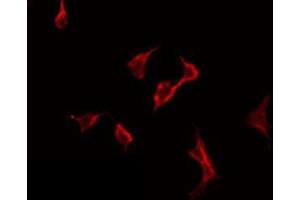 ABIN6275784 staining HeLa by IF/ICC. (PLA2G6 antibody  (Internal Region))