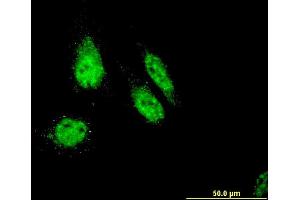 Immunofluorescence of monoclonal antibody to RHOXF1 on HeLa cell. (RHOXF1 antibody  (AA 1-110))